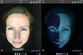 Observe 520 huidscan laat een SPF filter op de huid goed zien.